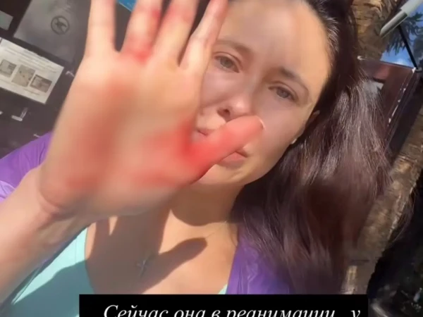 На Рублевке овчарка растерзала йорка актрисы из «Уральских пельменей» Иланы Дылдиной